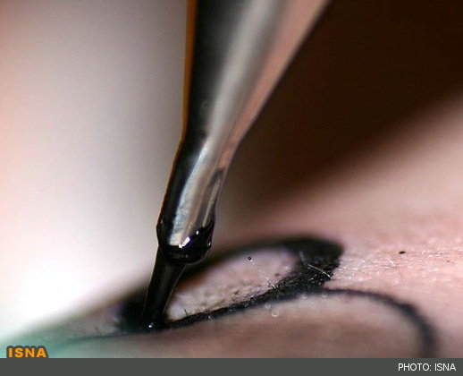 وقتی خالکوبی دردسرساز میشود تاتو