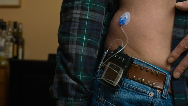 artificial-pancreas-1.jpg