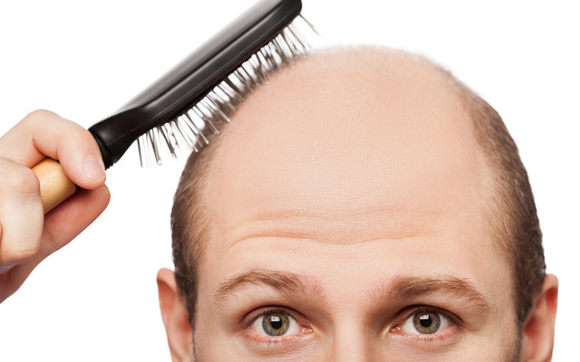1426623972_new-cure-for-baldness-ftr.jpg