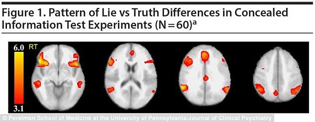 3A11DD1800000578-3906532-FMRI_picks_up_on_the_activation_of_decision_making_areas_in_the_-m-53_1478284997615.jpg