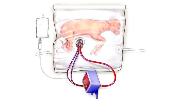 artificial-womb-2.jpg