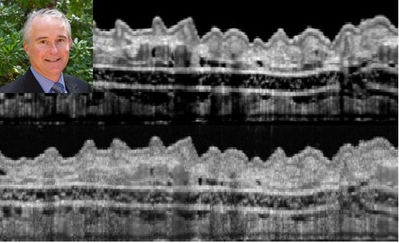 نفوذ به اعماق بافتهای بدن با اسکن OCT تقویت شده دایوش مشفقی