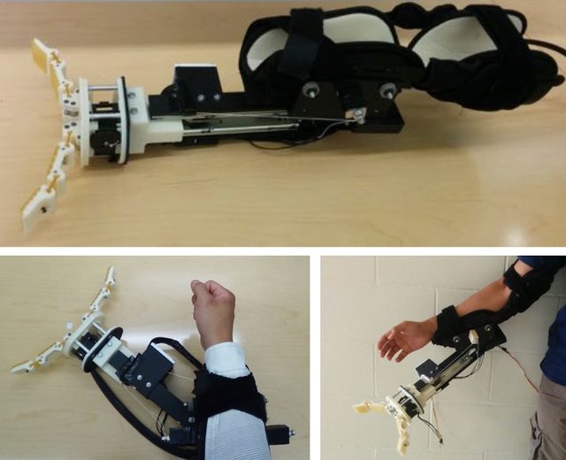 اولین آزمایش بازوی رباتیک در شرایط واقعی