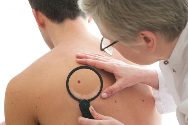 چگونه پرتوهای فرابنفش باعث سرطان پوست می‌شوند؟