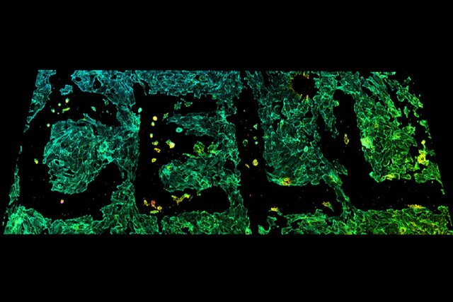 کشف اسرار سازماندهی سلولی