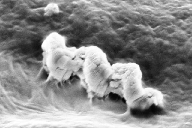 نانورباتهایی که ریشه دندان را درمان میکنند