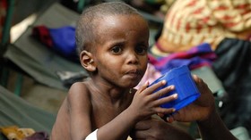 کرونا میلیون ها کودک را در جهان گرفتار سوء تغذیه می کند