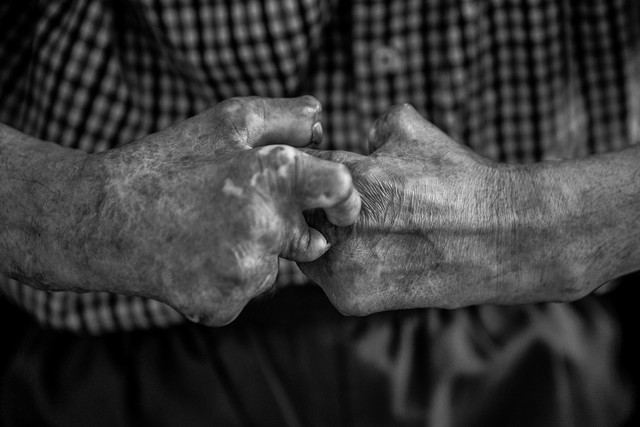 ۱۲مورد جدید جذام در سال گذشته / چالش شناسایی بیماری در کشور ۱۲مورد جدید جذام در سال گذشته / چالش شناسایی بیماری در کشور