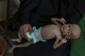 ۱۰ میلیون یمنی در یک قدمی گرسنگی