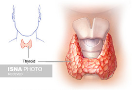 همه چیز درباره کم‌کاری تیروئید و درمان آن