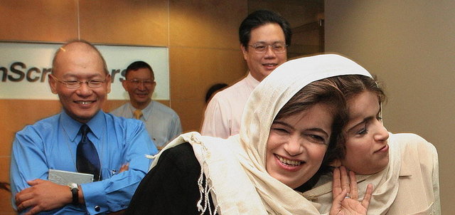 عجیبترین دوقلوهای جهان را بشناسید