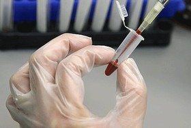 ذخیره‌سازی بیش از 250 نمونه خون بند ناف در چهارمحال و بختیاری