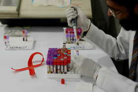 ویژگی‌های سویه متفاوت ویروس ایدز که در هلند شناسایی شد