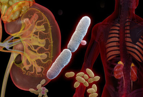 عکس تزیینی است. ناکارآمدی آنتیبیوتیکها در درمان عفونت ادراری / روش نوین انستیتوپاستور در درمان این بیماری