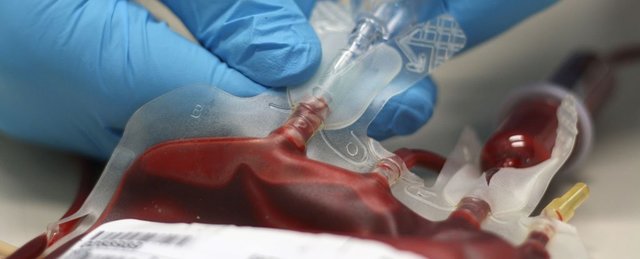 جوانسازی موشهای پیر با خون انسانهای جوان جوانسازی موشهای پیر با خون انسانهای جوان