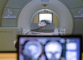 ساخت دستگاه MRI با وضوح بالا از سوی محقق ایرانی دانشگاه تایوان