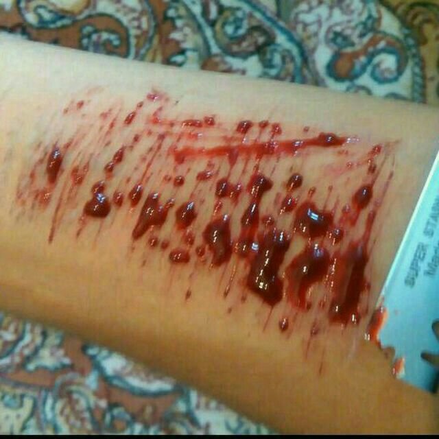 عکس تزئینی است کانالهایی که با انتشار تصاویر «آسیب به خود» نوجوانان را ترغیب به «خودزنی» میکنند