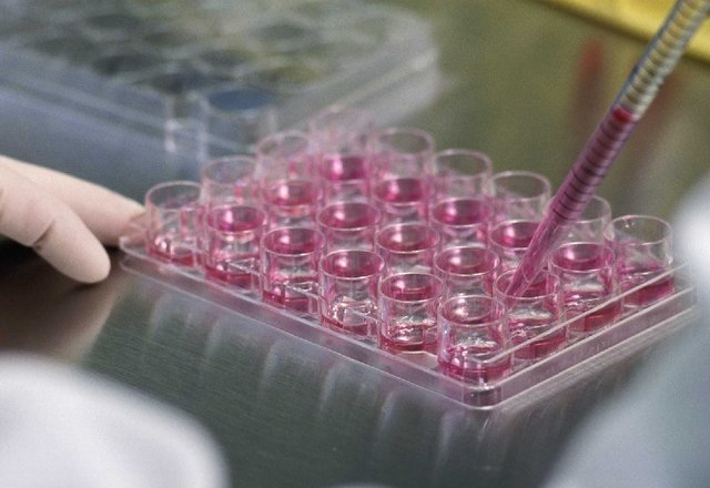 مرکز جامع سلولدرمانی و پزشکی بازساختی در کرمان افتتاح شد 1