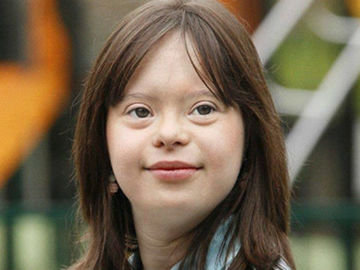 فیسبوک آرزوی دختر مبتلا به سندرم داون را برآورده کرد