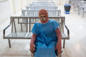 تصاویر دلخراش از حادثه دیدگان آتش بازیهای آخر سال