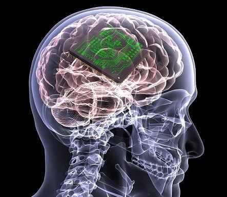 استفاده از تراشههای قابل کاشت در مغز برای کمک به افراد معلول استفاده از تراشههای قابل کاشت در مغز برای کمک به افراد معلول