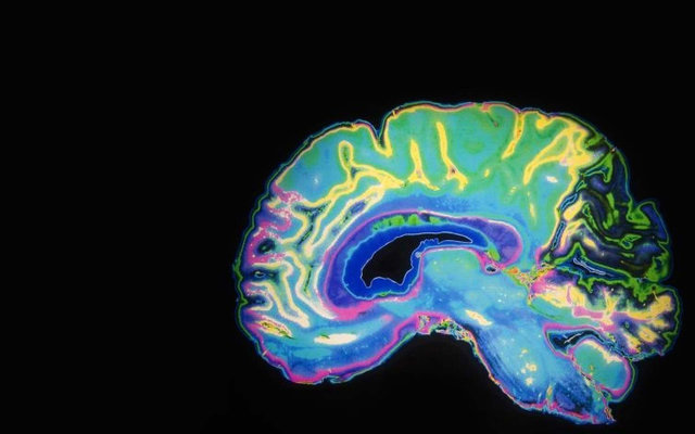 توسعه فناوری پوشیدنی برای نظارت بر عملکرد مناطق مختلف مغز 