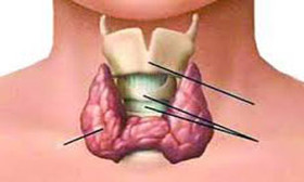 اختلالات تیروئید زنان را بیشتر گرفتار می‌کند