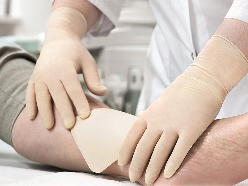 درمان و کاهش درد زخم‌های عفونی با پانسمان‌های پیشرفته محققان کشور