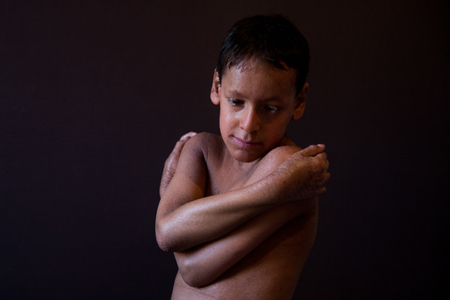 ویدئو/ پیدا و پنهان بیماران نادر ویدئو/ پیدا و پنهان بیماران نادر