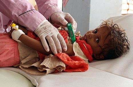 ویدئو / وضعیت اسفبار کودکان در یمن