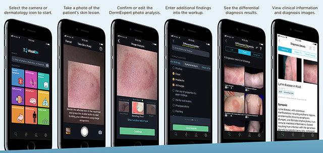 با iOS جدید یک متخصص پوست را به همراه دارید