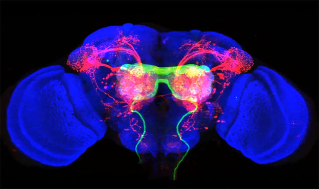 روشی جدید برای درک بیشتر بیماری‌های عصبی