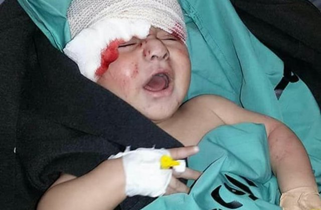 یک شهید و ۲۵ زخمی در حملات جنگنده‌های صهیونیستی به غزه