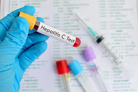 دو سوم سرطان‌های کبد به هپاتیت‌های B و C مربوط است/تلاش برای ریشه‌کنی هپاتیت تا ۲۰۳۰