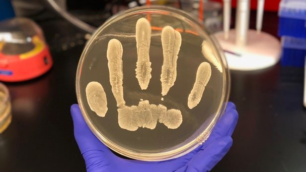 کشتن مولکول سرطان پوست توسط باکتری‌های معمولی دست