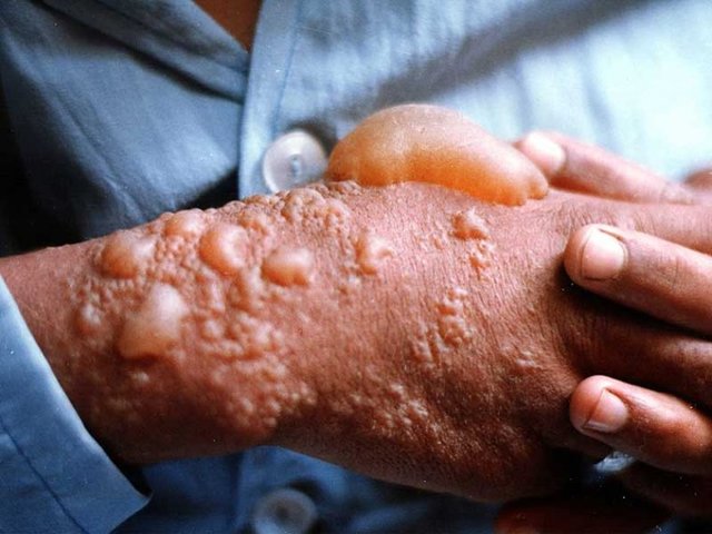 به او دست نزن؛ شیمیایی می‌شوی