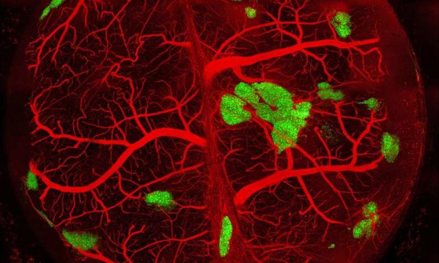 درمان دیابت در موش‌ها با سلول‌های مهندسی شده جزایر لانگرهانس انسانی