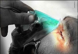 بازشدن گره کور مشکلات یک جانباز شیمیایی