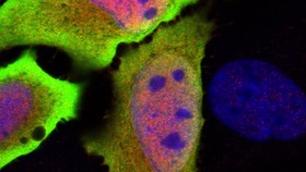 شناسایی ژن مرتبط با تولید پروتئین‌های ضد التهابی