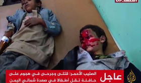  ۴۳  کشته و ۶۳  زخمی در حمله خونین سعودی‌ها به اتوبوس حامل کودکان در صعده یمن