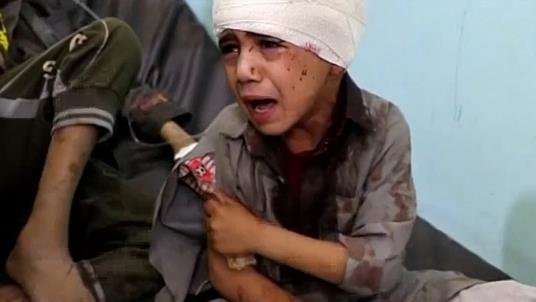 کشته و زخمی شدن ۲۷ کودک طی درگیری‌های ۱۰ روز اخیر یمن