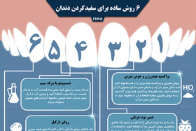 اینفوگرافی / ۶ روش ساده برای سفیدکردن دندان