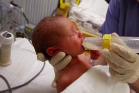 تاثیر تغذیه با شیر مادر بر کاهش مشکلات نوزادان نارس
