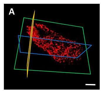 تصویربرداری ۳بعدی از باکتری با کمک اشعه ایکس (+عکس)
