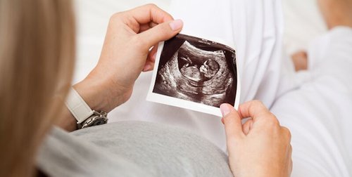 بارداری-سونوگرافی-سقط