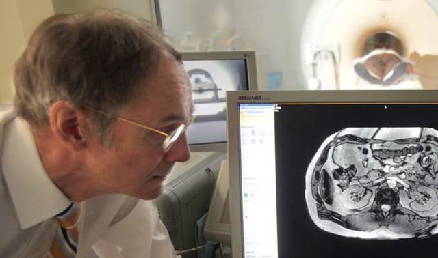 رژیم غذایی کالری پایین در درمان دیابت نوع ۲ موثر است