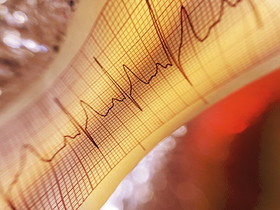 افزایش خطر بیماری‌های قلبی عروقی با یائسگی زودرس