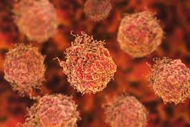 ژنی که از متاستاز سرطان پروستات پیشگیری می‌کند