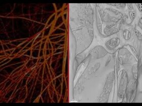 شناسایی یک رگ خونی جدید در استخوان‌ها!