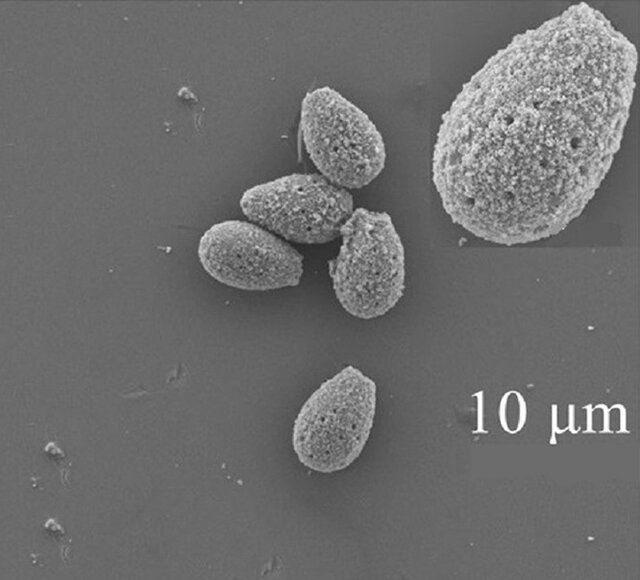 تشخیص باکتری "کلستریدیوم دیفیسل" در چند دقیقه با میکروربات